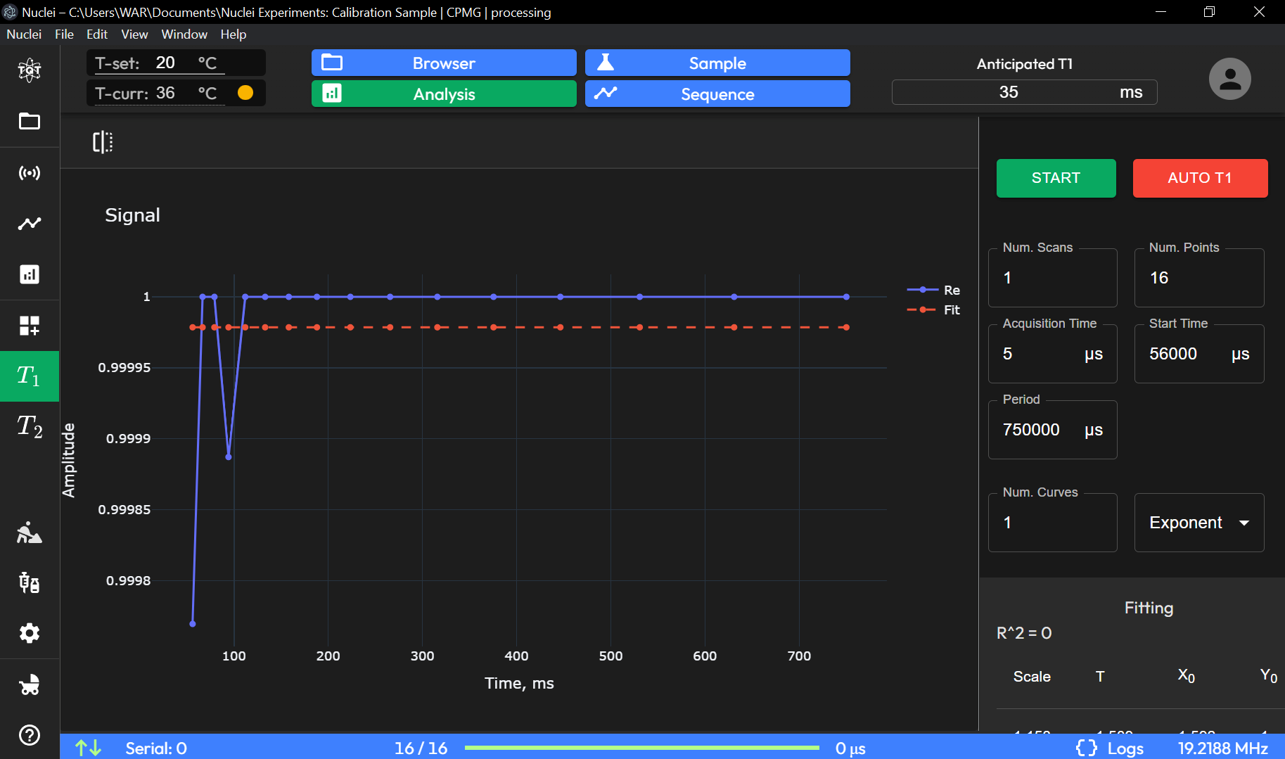 T1 Relaxation Time Measurement Image