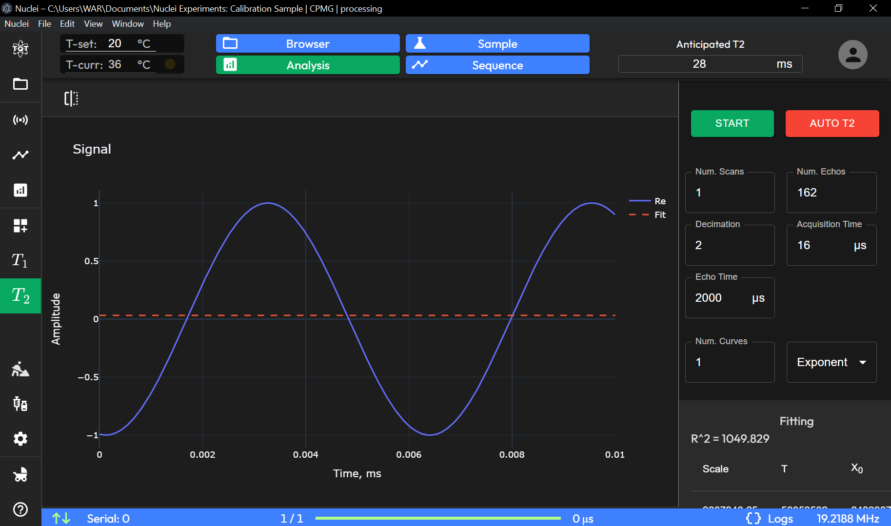 T2 Relaxation Time Measurement Image